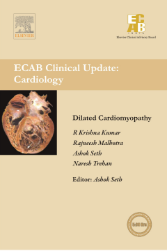 Dilated Cardiomyopathy - ECAB Dilated Cardiomyopathy - ECAB