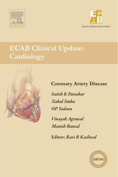 Coronary Artery Disease - ECAB Coronary Artery Disease - ECAB