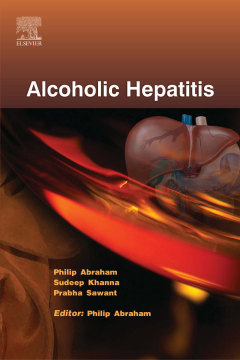 Alcoholic Hepatitis - ECAB Alcoholic Hepatitis - ECAB