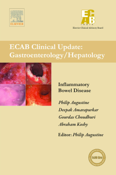 Inflammatory Bowel Diseases - ECAB Inflammatory Bowel Diseases - ECAB