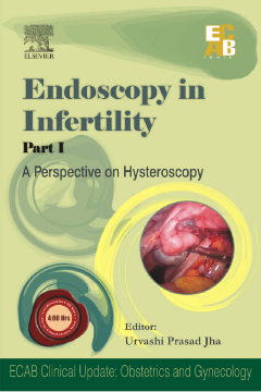 Endoscopy in Infertility - ECAB Endoscopy in Infertility - ECAB