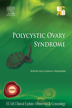 Polycystic Ovary Syndrome - ECAB Polycystic Ovary Syndrome - ECAB