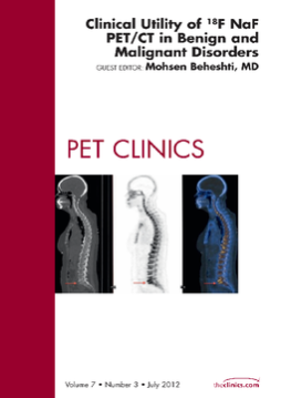 Clinical Utility of 18NaF PET/CT in Benign and Malignant Disorders, An Issue of PET Clinics - E-Book