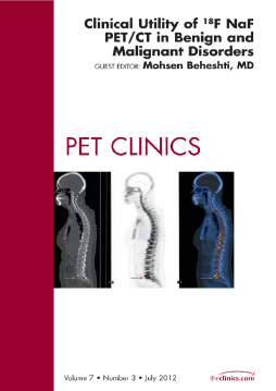 Clinical Utility of 18NaF PET/CT in Benign and Malignant Disorders, An Issue of PET Clinics - E-Book Clinical Utility of 18NaF PET/CT in Benign and Malignant Disorders, An Issue of PET Clinics - E-Book