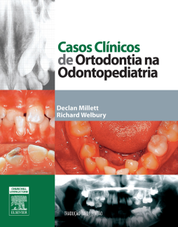 Casos Clínicos de Ortodontia na Odontopediatria Casos Clínicos de Ortodontia na Odontopediatria