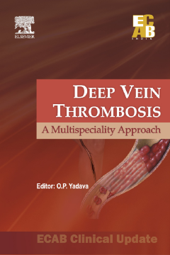 Deep Vein Thrombosis - ECAB Deep Vein Thrombosis - ECAB