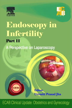 Endoscopy in Infertility - Part II - A Perspective on Laparoscopy - ECAB Endoscopy in Infertility - Part II - A Perspective on Laparoscopy - ECAB