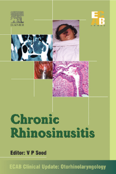 Chronic Rhinosinusitis - ECAB Chronic Rhinosinusitis - ECAB