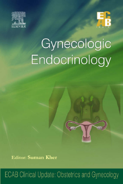 Gynecologic Endocrinology - ECAB Gynecologic Endocrinology - ECAB