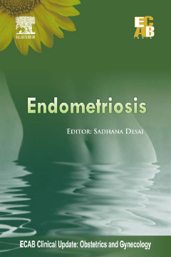 Endometriosis - ECAB Endometriosis - ECAB