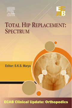 Total Hip Replacement Spectrum - ECAB Total Hip Replacement Spectrum - ECAB