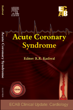 Acute Coronary Syndrome - ECAB Acute Coronary Syndrome - ECAB