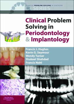Clinical Problem Solving in Periodontology and Implantology - E-Book Clinical Problem Solving in Periodontology and Implantology - E-Book