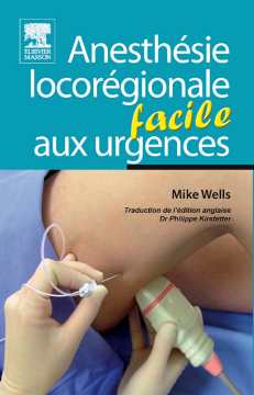Anesthésie locorégionale facile aux urgences Anesthésie locorégionale facile aux urgences