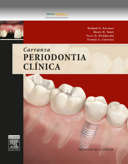 Carranza Periodontia Clínica Carranza Periodontia Clínica