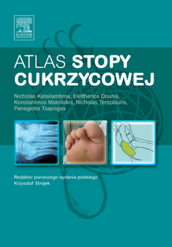 Atlas stopy cukrzycowej Atlas stopy cukrzycowej