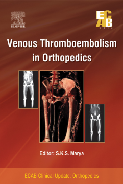 Venous Thromboembolism in Orthopedics - ECAB Venous Thromboembolism in Orthopedics - ECAB