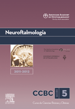 Neuroftalmología. 2011-2012 Neuroftalmología. 2011-2012
