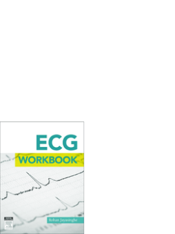 ECG workbook - E-Book