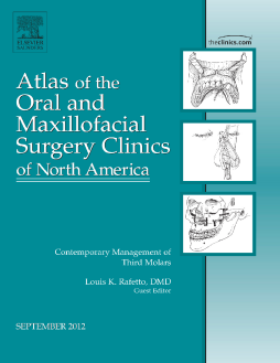 Contemporary Management of Third Molars, An Issue of Atlas of the Oral and Maxillofacial Surgery Clinics Contemporary Management of Third Molars, An Issue of Atlas of the Oral and Maxillofacial Surgery Clinics