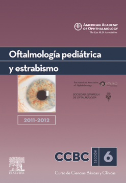 Oftalmología pediátrica y estrabismo. 2011-2012 Oftalmología pediátrica y estrabismo. 2011-2012
