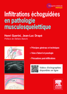 Infiltrations échoguidées Infiltrations échoguidées