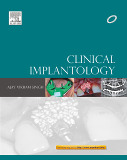 Clinical Implantology - E-Book Clinical Implantology - E-Book