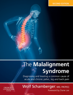The Malalignment Syndrome E-Book