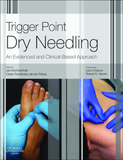 Trigger Point Dry Needling E-Book Trigger Point Dry Needling E-Book