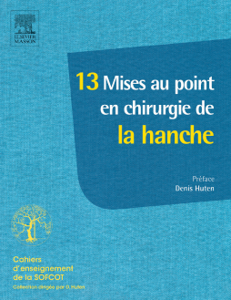 13 Mises au point en chirurgie de la hanche 13 Mises au point en chirurgie de la hanche