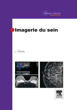 Imagerie du sein Imagerie du sein