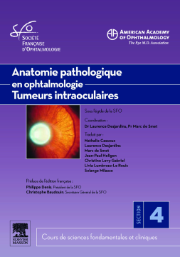 Anatomie pathologique en ophtalmologie. Tumeurs intraoculaires Anatomie pathologique en ophtalmologie. Tumeurs intraoculaires