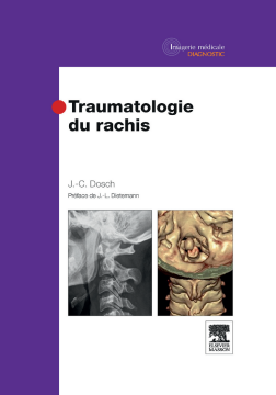 Traumatologie du rachis Traumatologie du rachis