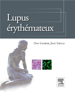 Lupus érythémateux Lupus érythémateux