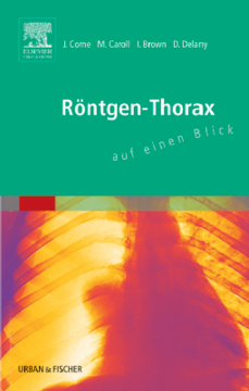 Röntgen-Thorax auf einen Blick Röntgen-Thorax auf einen Blick