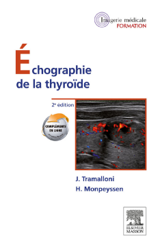 Échographie de la thyroïde Échographie de la thyroïde