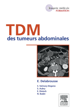 TDM des tumeurs abdominales TDM des tumeurs abdominales