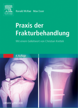 Praxis der Frakturbehandlung Praxis der Frakturbehandlung