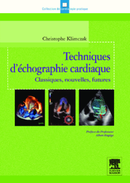 Techniques d'échographie cardiaque