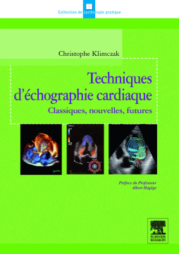 Techniques d'échographie cardiaque Techniques d'échographie cardiaque