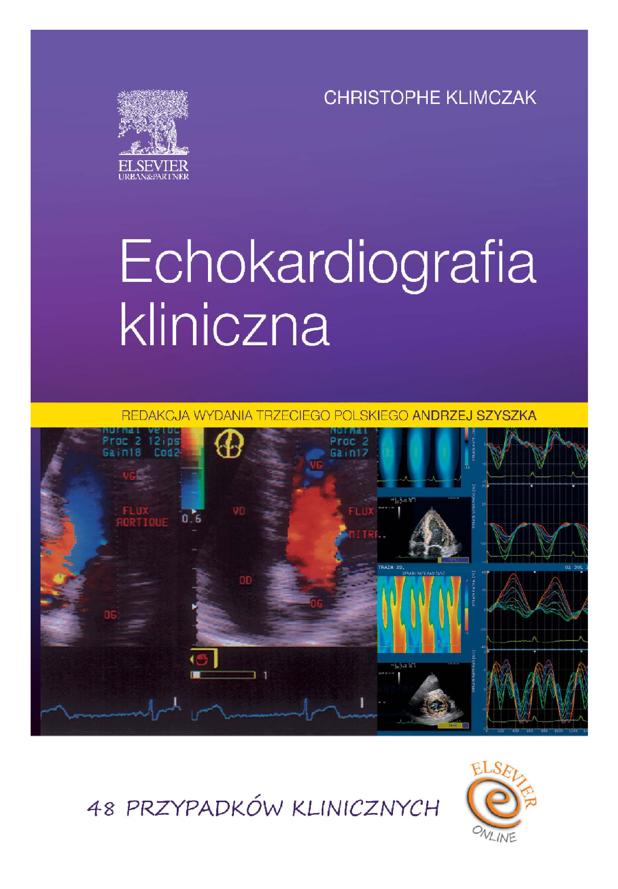Echokardiografia kliniczna