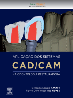 Aplicação dos Sistemas CAD/CAM na Odontologia