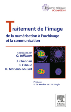 Traitement de l'image Traitement de l'image