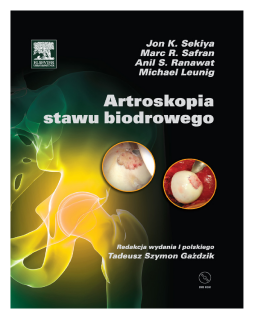 Artroskopia stawu biodrowego Artroskopia stawu biodrowego