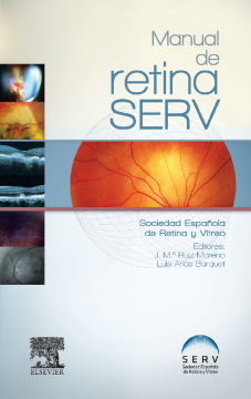 Manual de retina SERV Manual de retina SERV