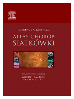 Atlas chorób siatkówki Atlas chorób siatkówki